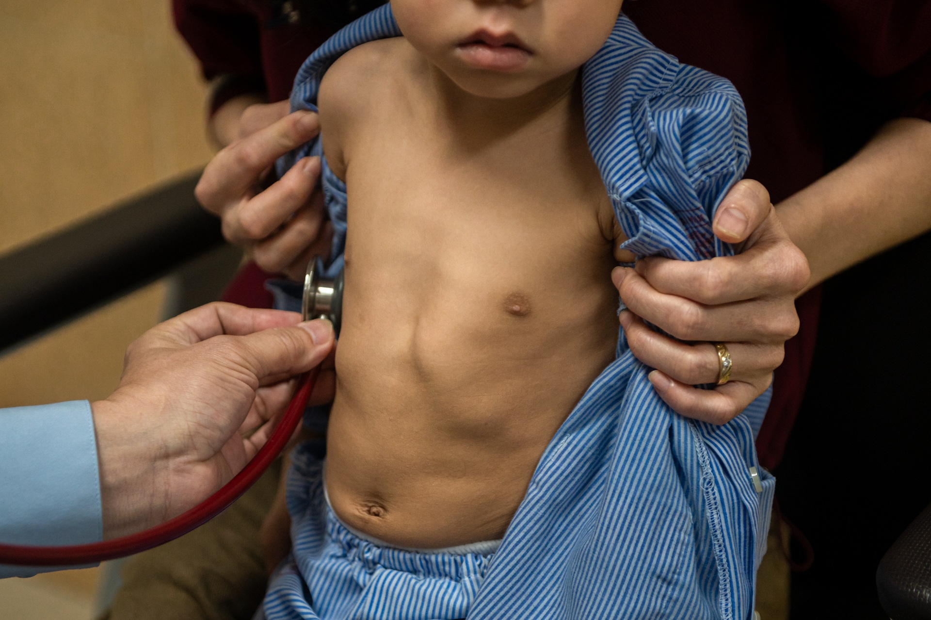 Ca mổ khép lại những đêm trắng mẹ khóc nghẹn vì con liên tục ngưng thở - 3