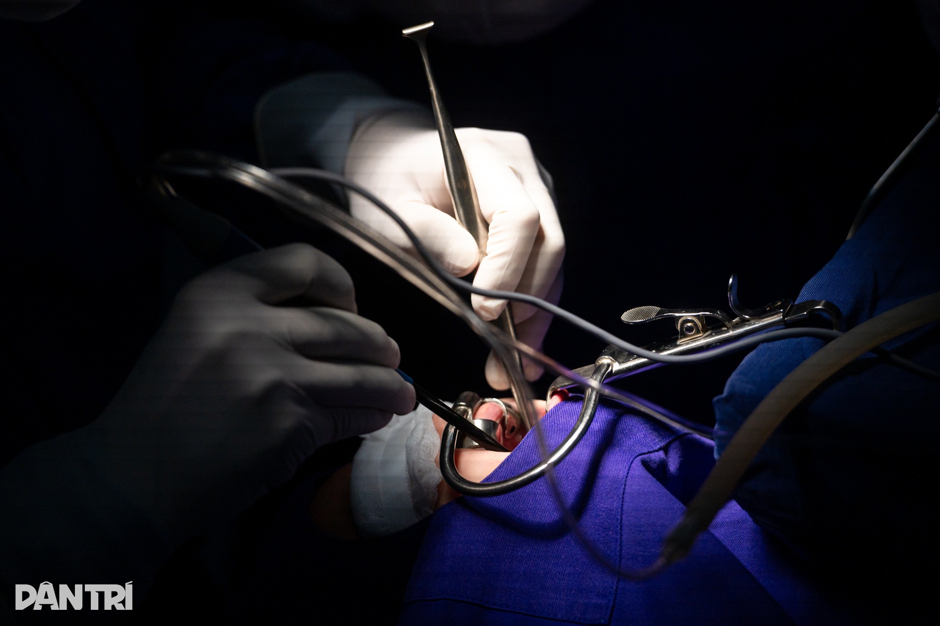 Ca mổ khép lại những đêm trắng mẹ khóc nghẹn vì con liên tục ngưng thở - 14