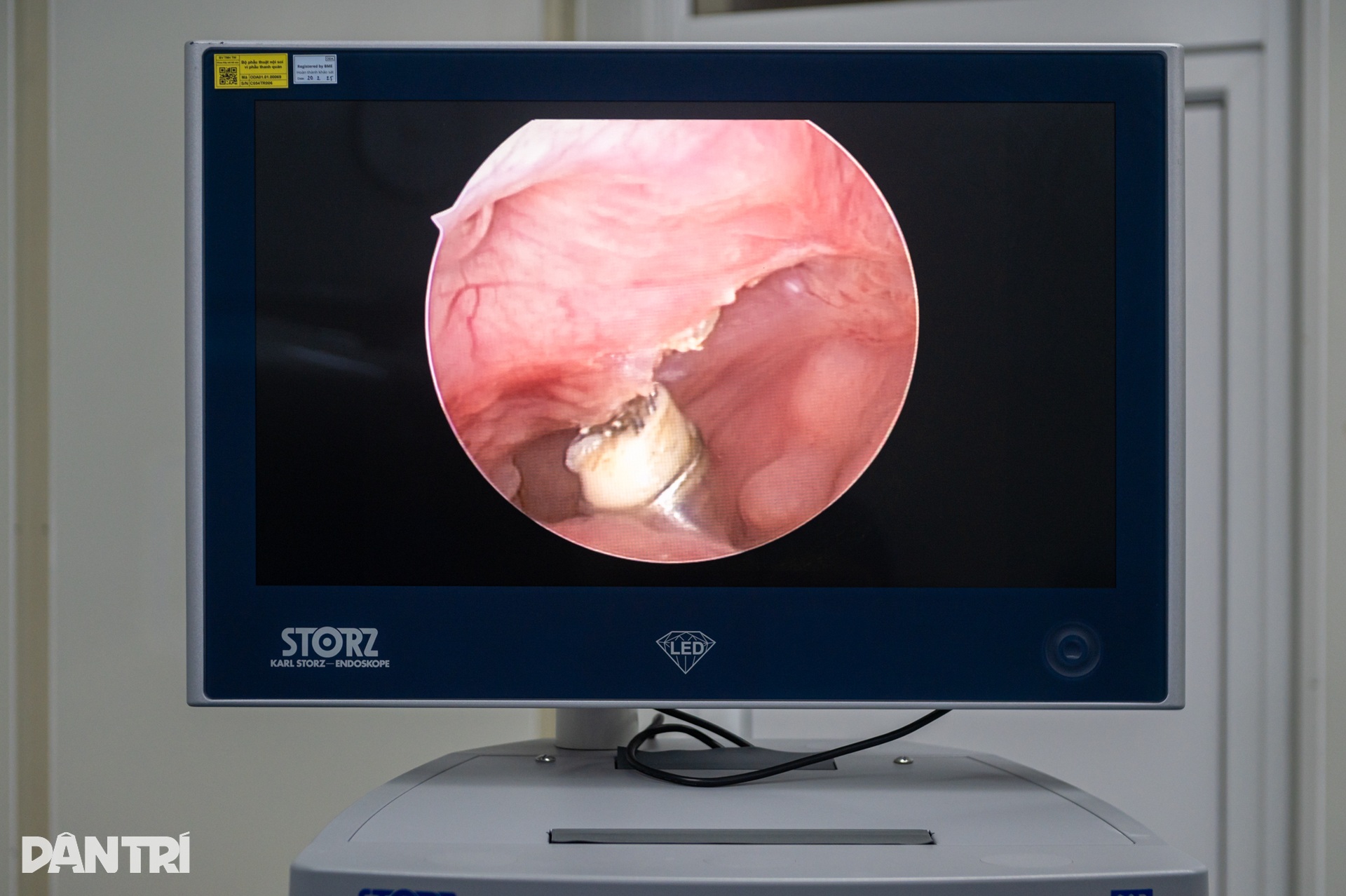 Ca mổ khép lại những đêm trắng mẹ khóc nghẹn vì con liên tục ngưng thở - 15