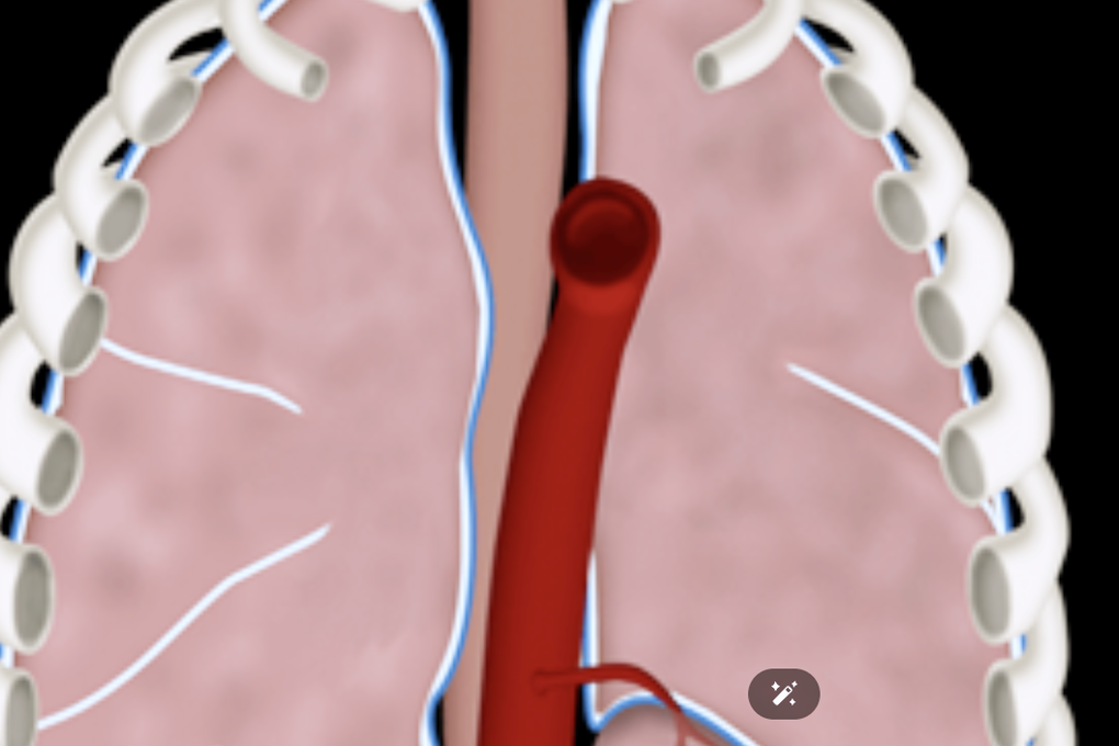 Ca mổ robot chữa bệnh hiếm gặp, lần đầu tiên thực hiện ở Việt Nam - 3