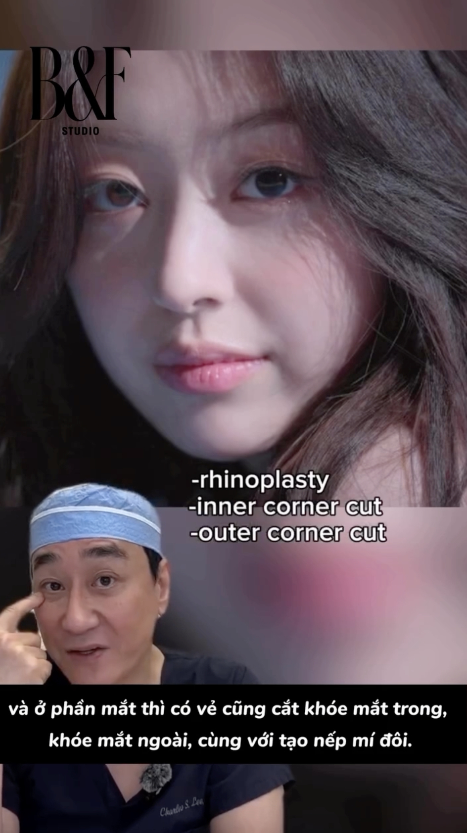 Gái xinh hot nhất show hẹn hò lên tiếng sau màn phanh phui 