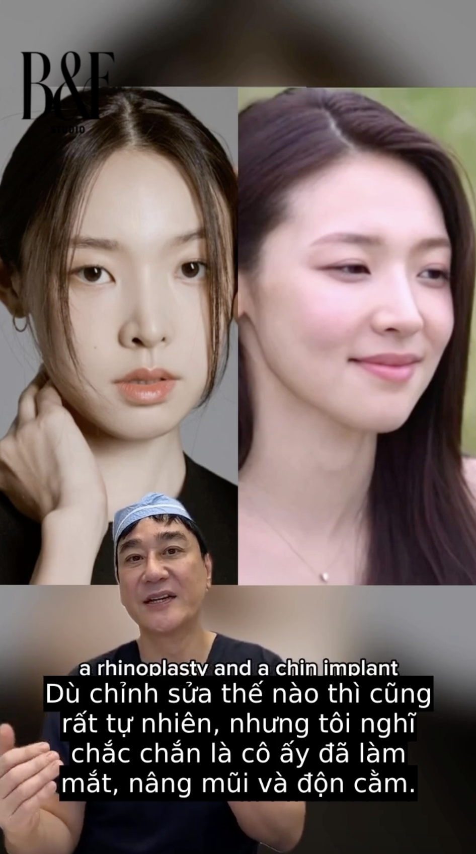 Gái xinh hot nhất show hẹn hò lên tiếng sau màn phanh phui 