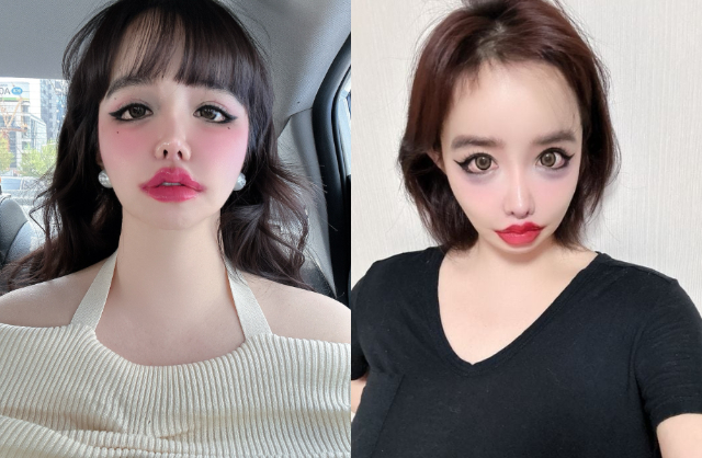 Tình trạng đáng lo ngại của Park Bom sau khi viết tâm thư gây sốc 