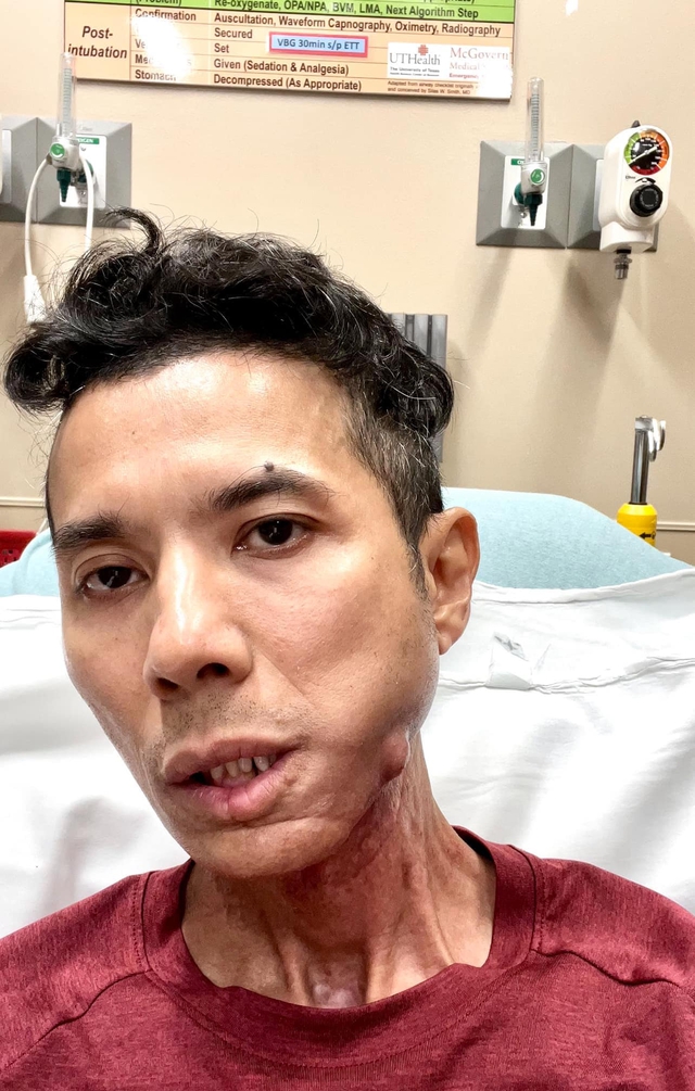 Nam ca sĩ Việt vừa qua đời: Quán quân Sao Mai, gương mặt biến dạng vì bạo bệnh- Ảnh 5.