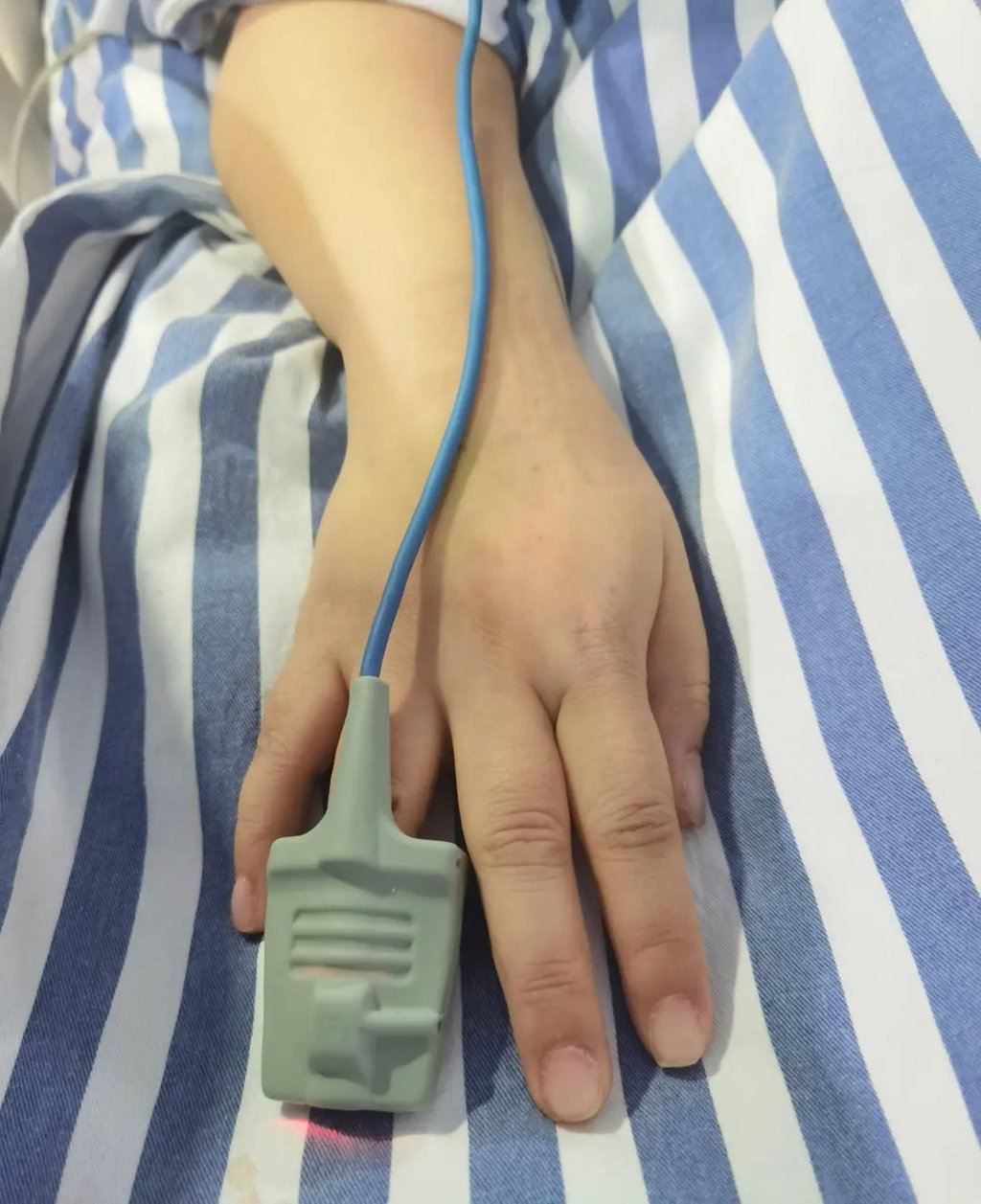 Cô gái nguy kịch khi nhập viện cấp cứu nhưng không thể lắp máy hỗ trợ vì bộ móng úp- Ảnh 2.