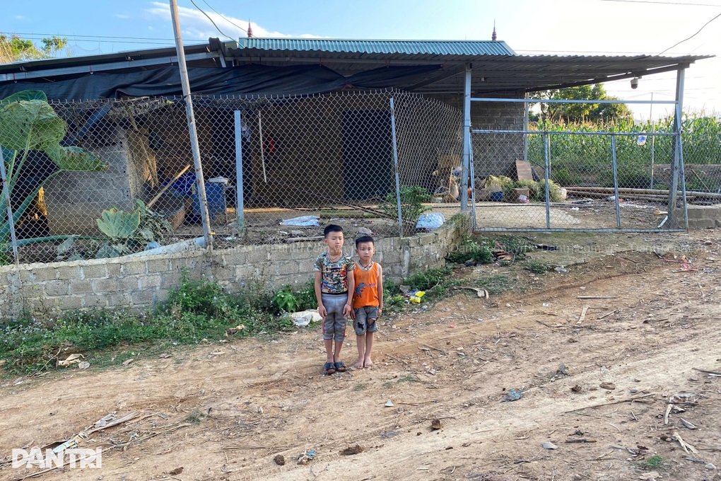 Vợ bán nương, khẩn cầu cứu chồng bỏng 66% cơ thể, có 95% cơ hội sống - 4