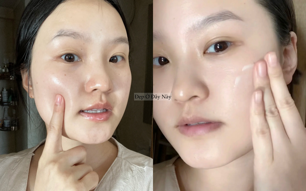 Tạm biệt da dầu bóng nhẫy, cô nàng này tìm ra cách khiến da ráo mịn và ngừa lão hóa- Ảnh 4.