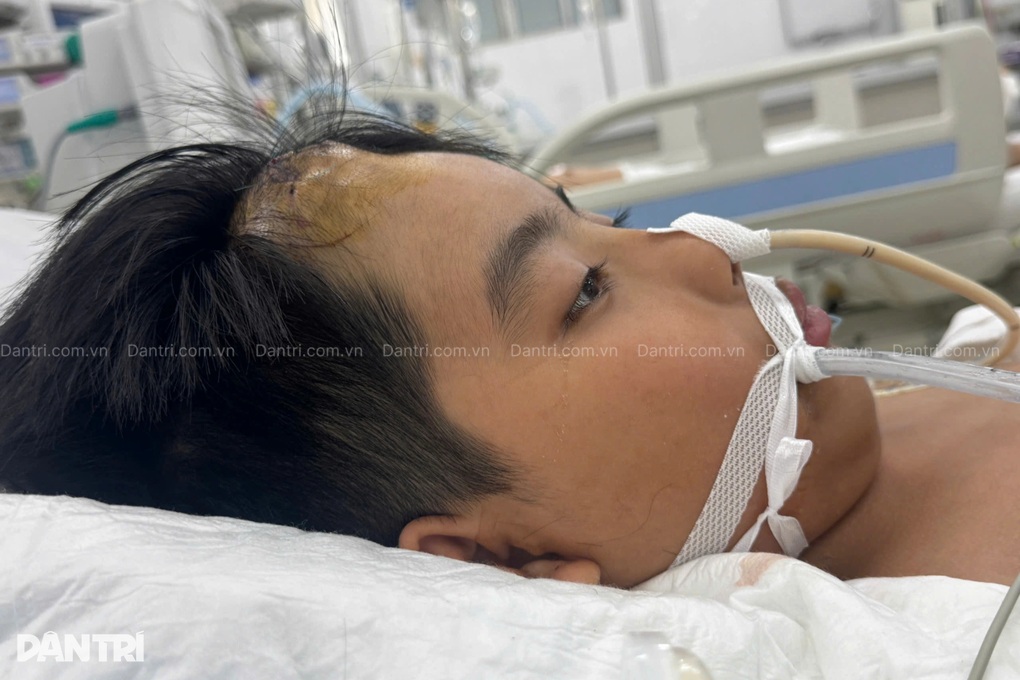 Ám ảnh ánh mắt khát sống của cậu bé 13 tuổi mắc u não, suy tim cấp - 2
