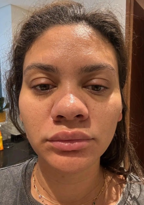 Gương mặt của Pitkin lúc chưa trang điểm. Ảnh: Amber Pitkin