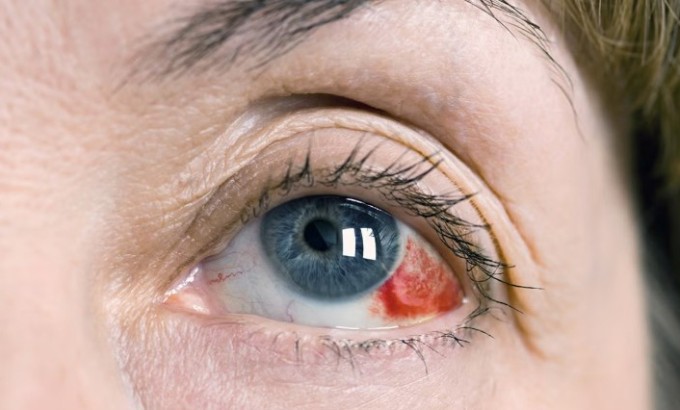 Ảnh minh họa: Medical News Today