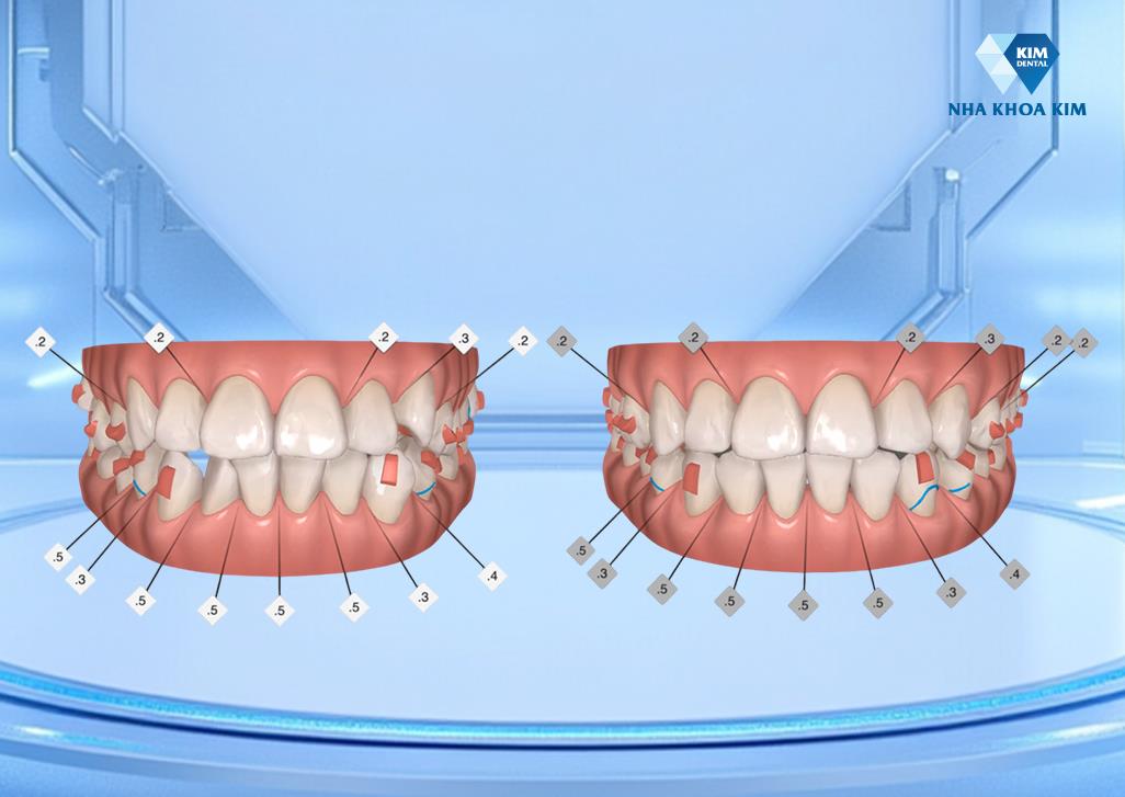 Nha khoa Kim - Ảnh 3.