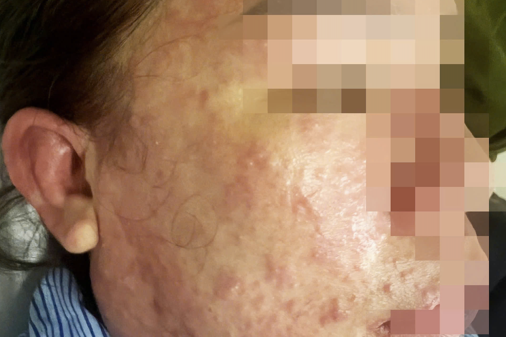 Nhiều người Việt không chịu nhận béo phì, chỉ thấy hơi thừa cân một chút - 2