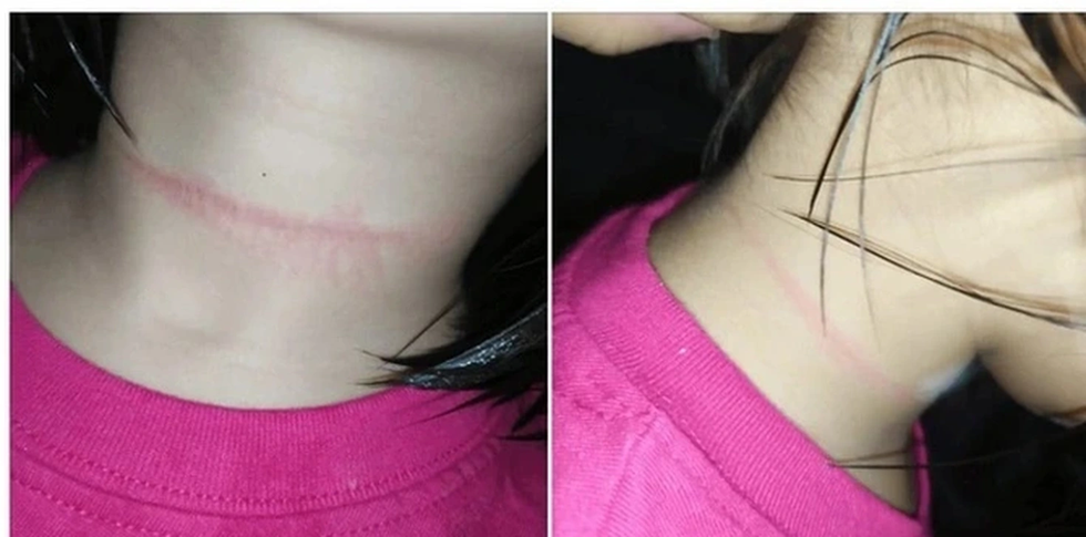 Chuyên gia cảnh báo trào lưu “ngủ 6 giây” trên TikTok có thể gây chết người - 3