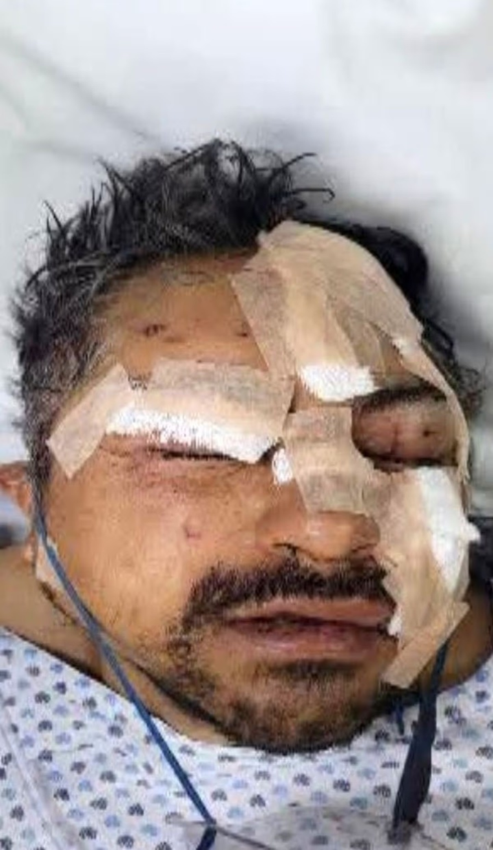 Mexico: Người đàn ông say rượu thả 6 con sư tử khỏi chuồng, cái kết đau đớn - 2