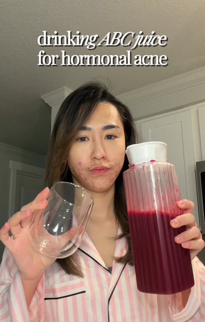 Bị đuổi việc, cô gái 27 tuổi để mặt mộc với mảng mụn lớn lên mạng tâm sự và cái kết bất ngờ- Ảnh 2. Bị đuổi việc, cô gái 27 tuổi để mặt mộc với mảng mụn lớn lên mạng tâm sự và cái kết bất ngờ- Ảnh 2.