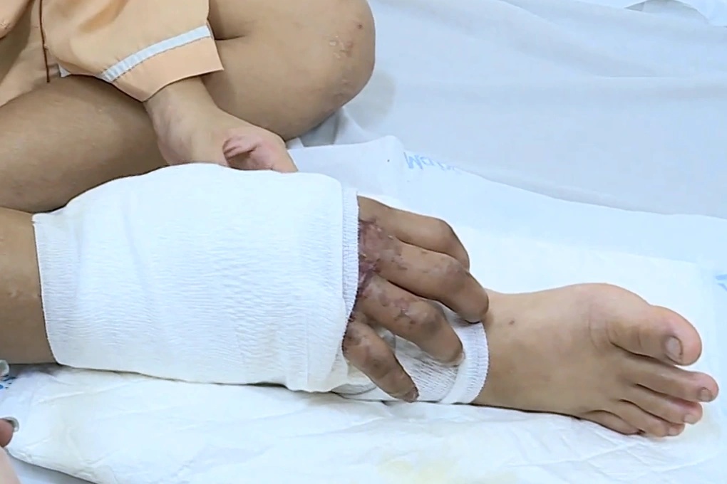 Từng gây chấn động với ca ghép bàn tay đứt lìa vào chân khi đang mang song thai, cuộc sống hiện tại của người mẹ đơn thân giờ ra sao?- Ảnh 2.