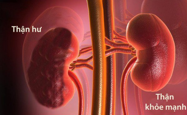 Thực phẩm ngon ngọt nhưng ăn nhiều có thể tăng nguy cơ suy thận, người Việt nên kiểm soát để phòng bệnh 4 Ảnh minh họa.