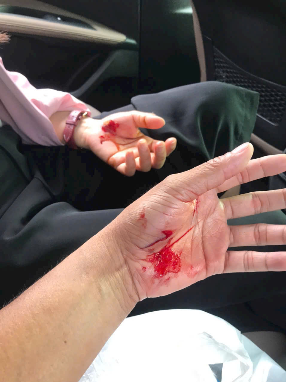 Nỗi ám ảnh mang tên chó thả rông 4 Nỗi ám ảnh mang tên chó thả rông tại một khu dân cư ở Nhà Bè - Ảnh 4.