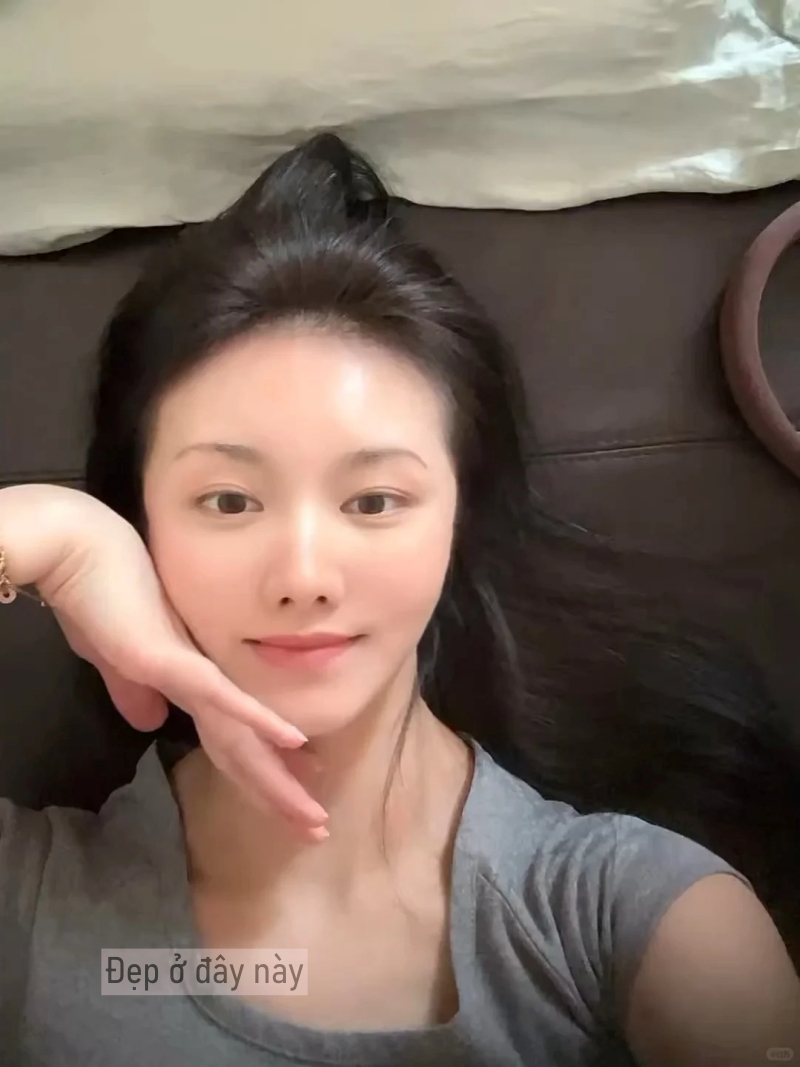 44 tuổi, tôi trị nám thành công nhờ thay đổi 6 thói quen và nhận ra rằng không phải cứ bôi nhiều là tốt- Ảnh 2.