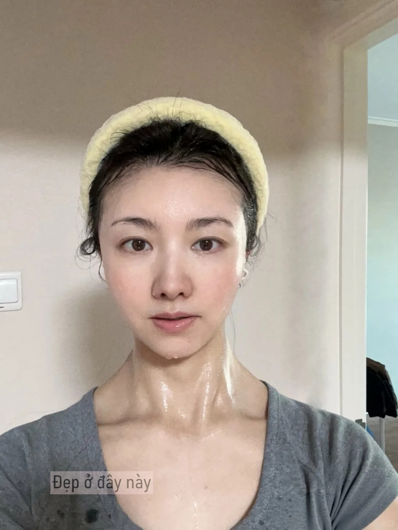 44 tuổi, tôi trị nám thành công nhờ thay đổi 6 thói quen và nhận ra rằng không phải cứ bôi nhiều là tốt- Ảnh 10.