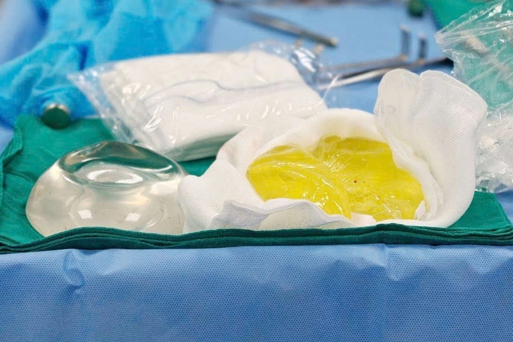 Cô gái cầu cứu bác sĩ vì vòng một bất ngờ xẹp một bên - 2