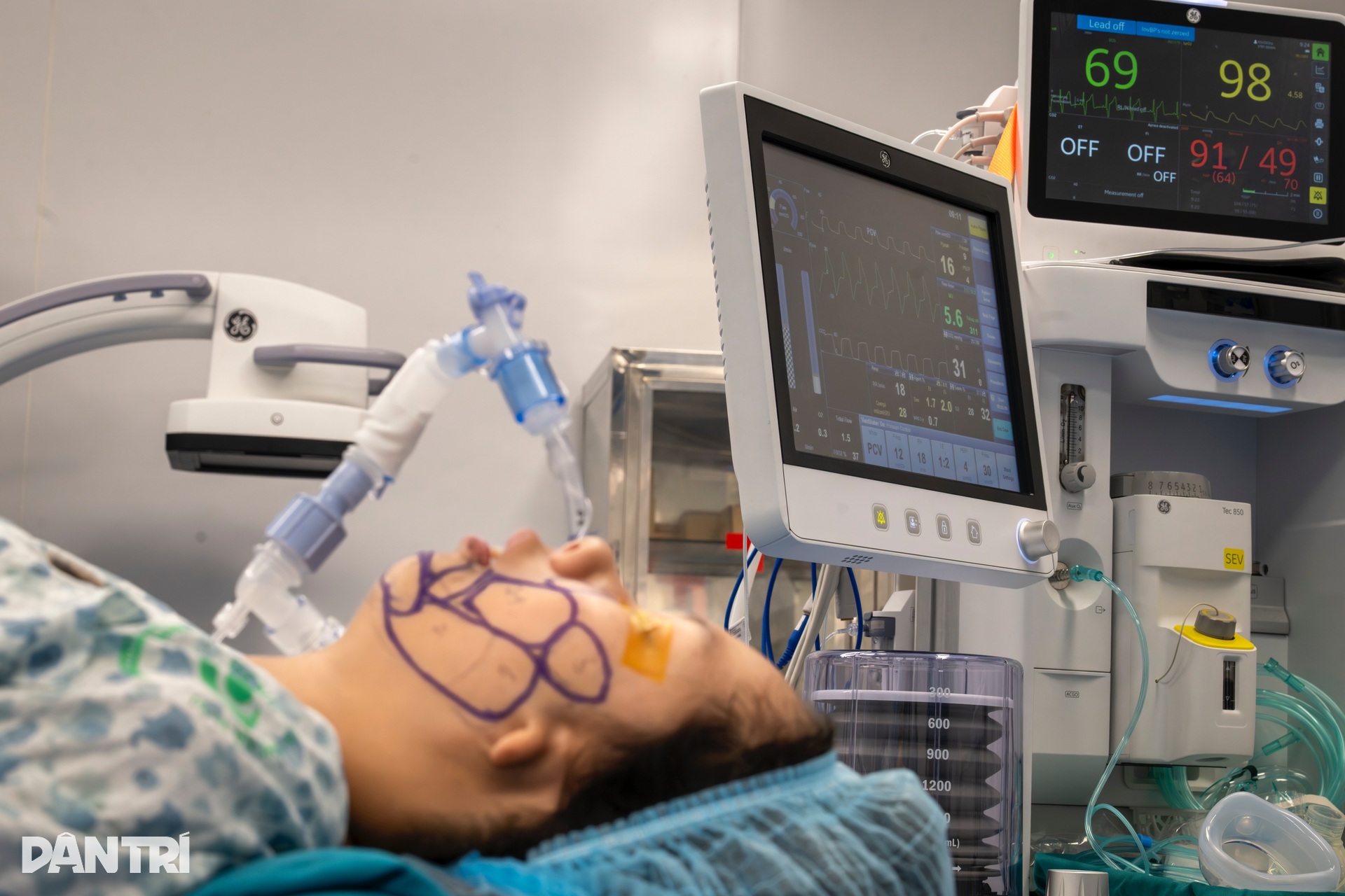 Ca mổ đặc biệt: Bác sĩ Việt - Mỹ cùng tạc lại gương mặt vẹn tròn cho em thơ - 10