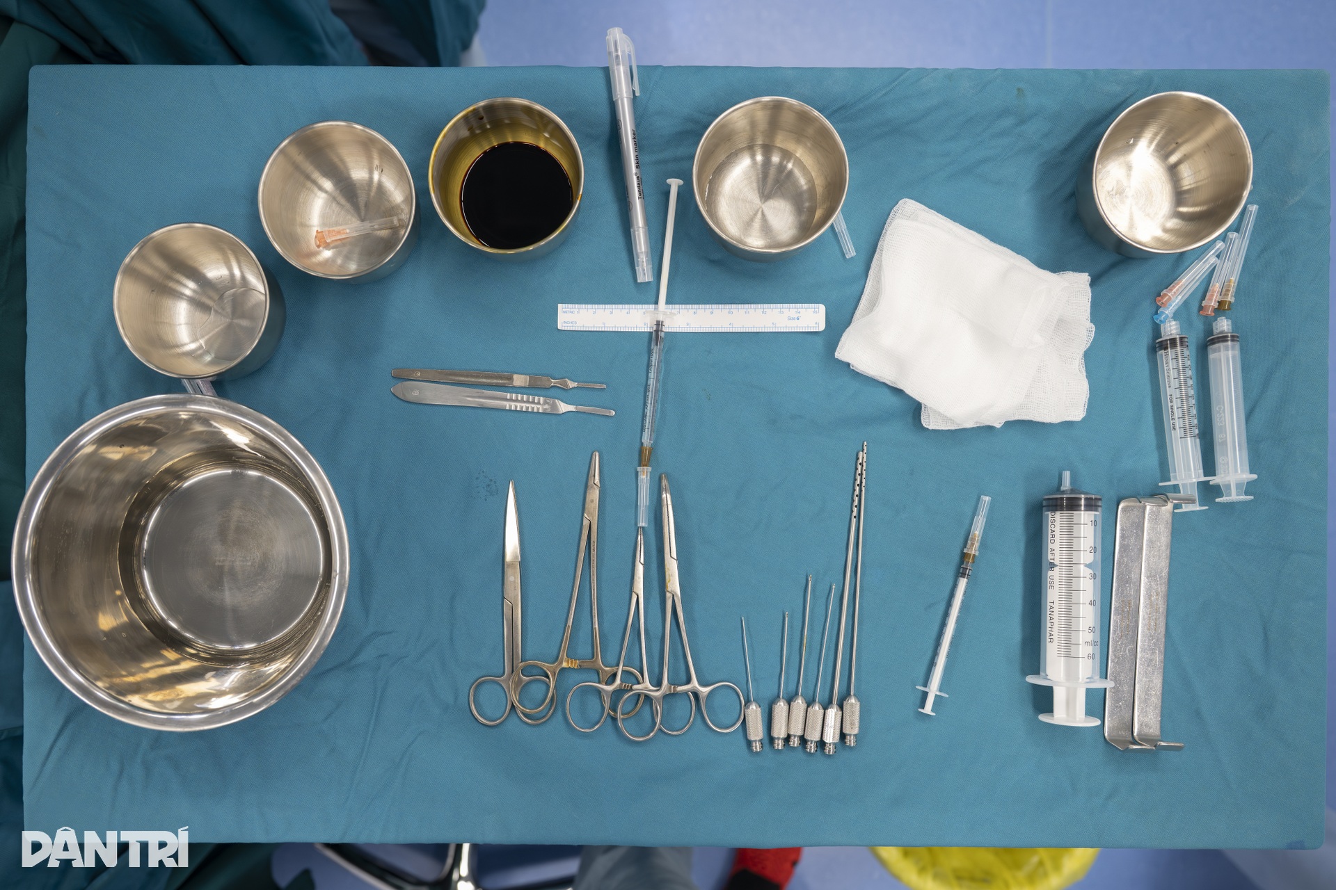 Ca mổ đặc biệt: Bác sĩ Việt - Mỹ cùng tạc lại gương mặt vẹn tròn cho em thơ - 11