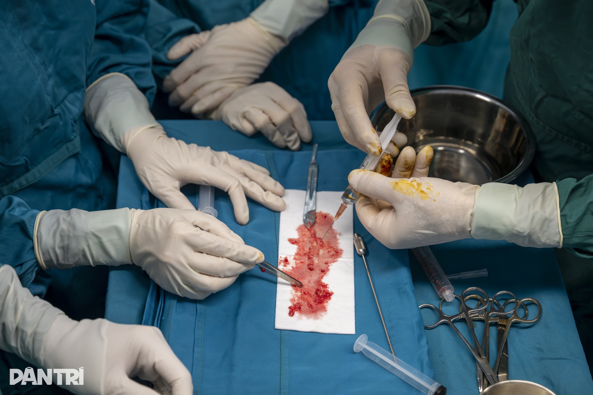 Ca mổ đặc biệt: Bác sĩ Việt - Mỹ cùng tạc lại gương mặt vẹn tròn cho em thơ - 15