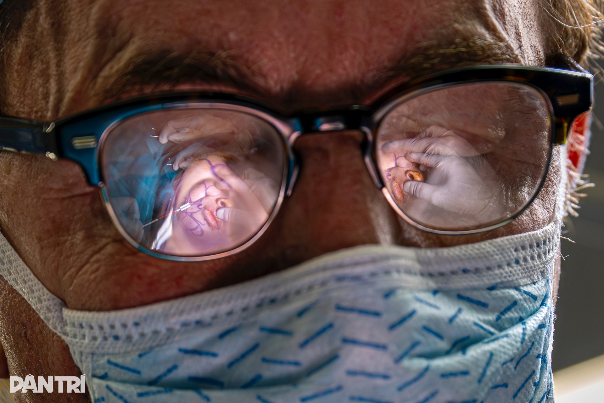 Ca mổ đặc biệt: Bác sĩ Việt - Mỹ cùng tạc lại gương mặt vẹn tròn cho em thơ - 20