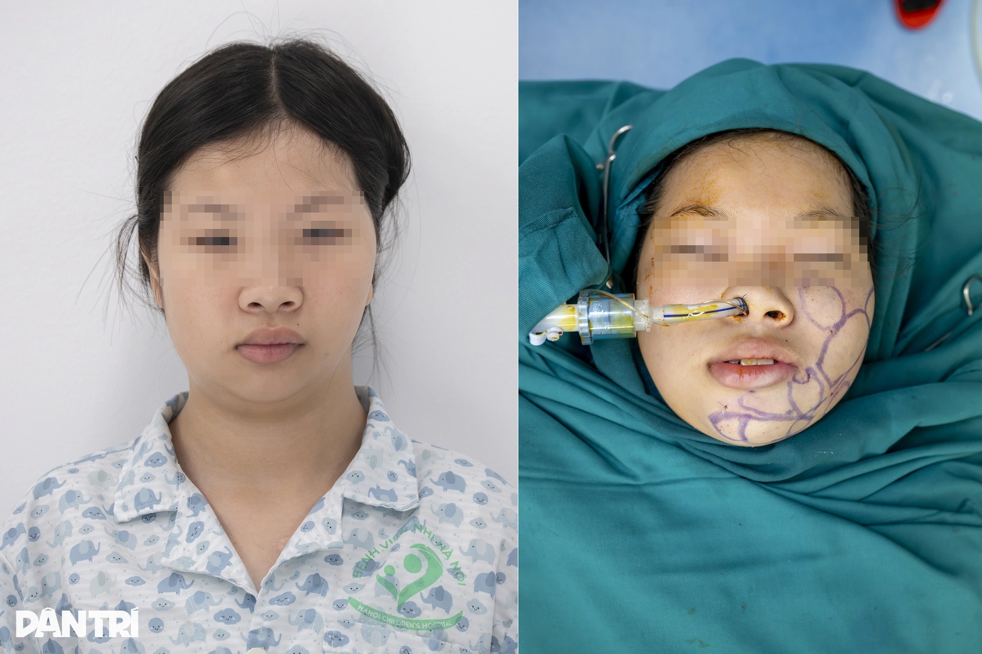 Ca mổ đặc biệt: Bác sĩ Việt - Mỹ cùng tạc lại gương mặt vẹn tròn cho em thơ - 21