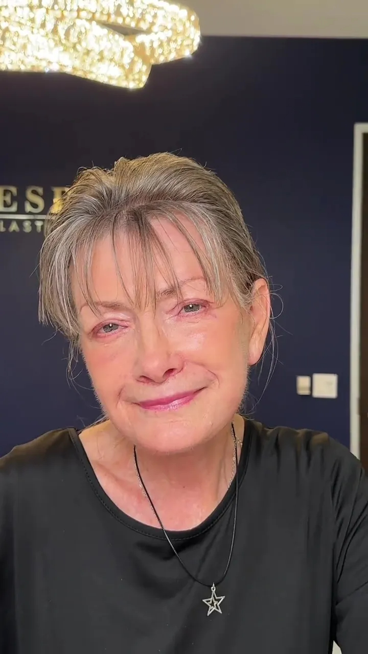 Bác sĩ thẩm mỹ được đặt lịch ồ ạt tới tận... 50 năm sau nhờ màn cải lão hoàn đồng thành công cho khách hàng- Ảnh 2.