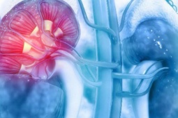 Cô gái 28 tuổi đối diện nguy cơ suy thận từ sai lầm trong lúc giảm cân nhiều người Việt mắc phải