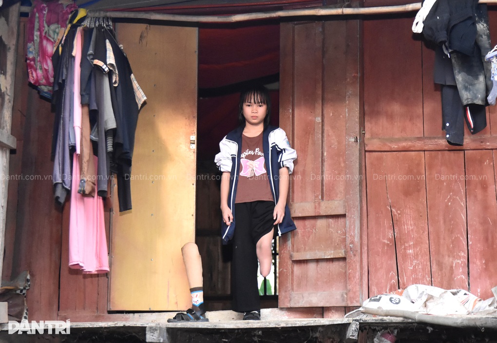 Bé gái cụt chân mồ côi cha, thiếu hơi ấm mẹ, chống chọi bệnh tật, nghèo khó - 4