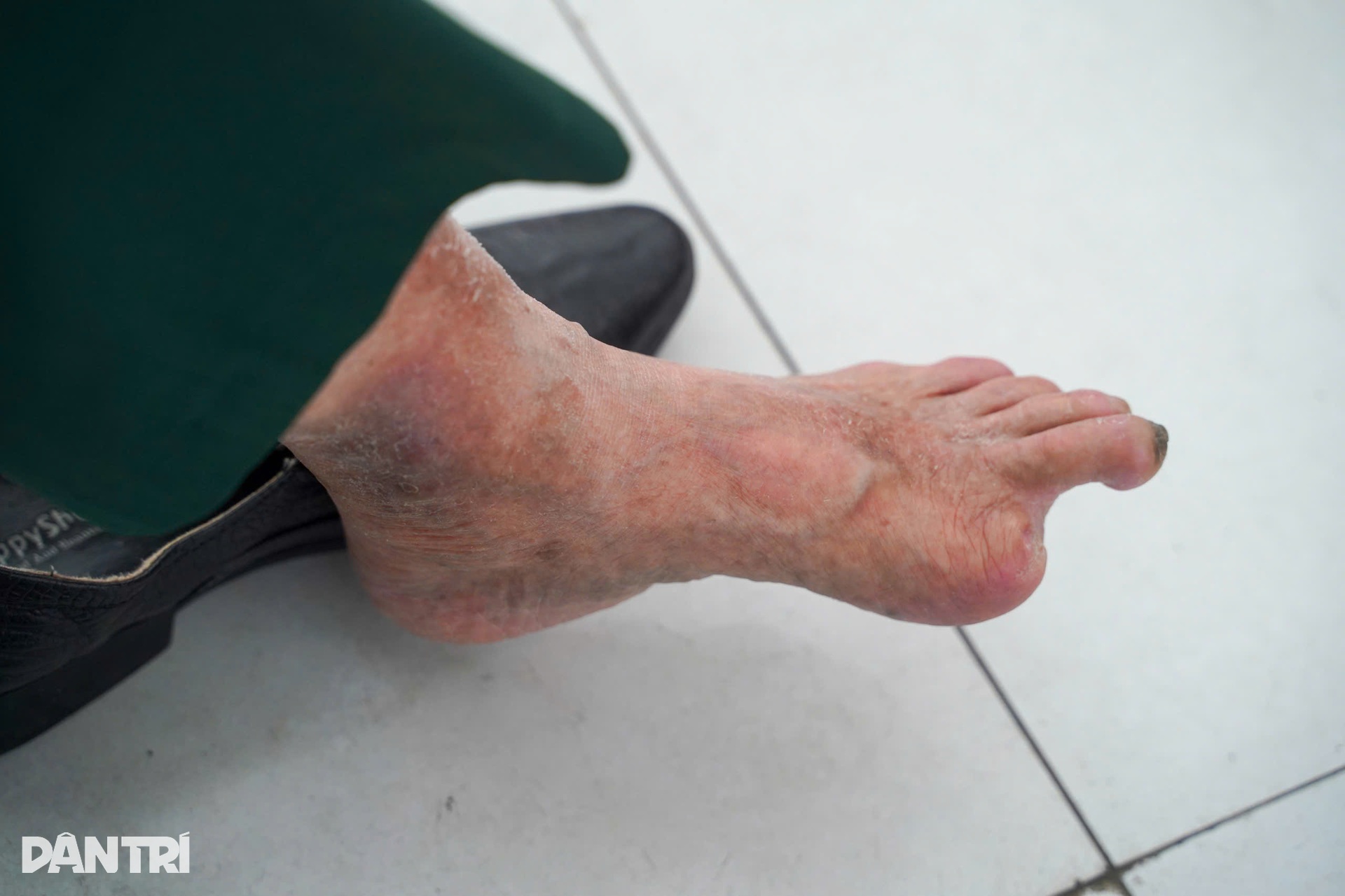 Hơn 300 cựu thanh niên xung phong, nạn nhân dioxin được khám miễn phí - 14 Hơn 300 cựu thanh niên xung phong, nạn nhân dioxin được khám miễn phí - 14