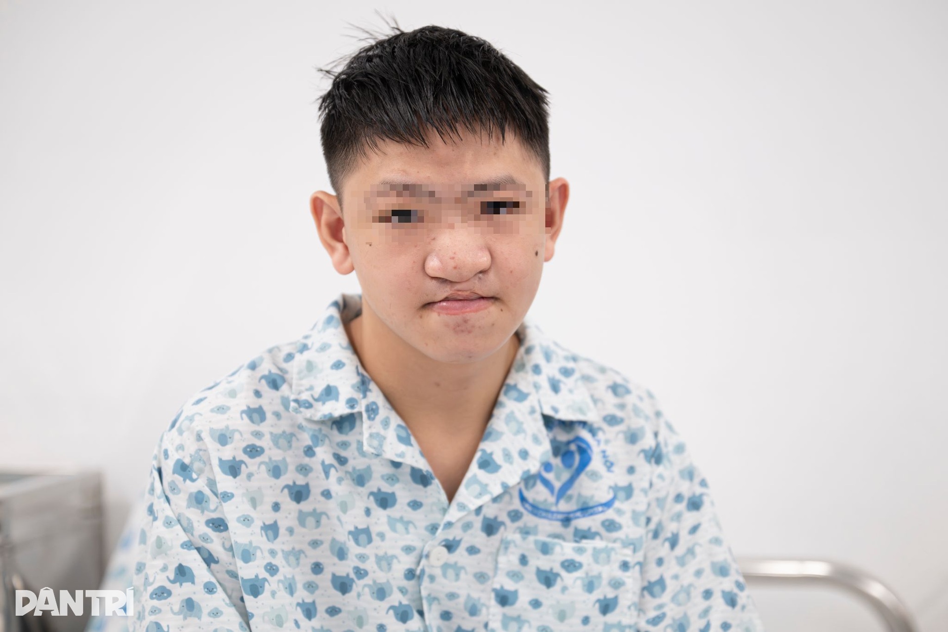 Hồi hộp xem đôi tay bác sĩ Việt - Mỹ tái tạo gương mặt cậu bé dị tật - 2