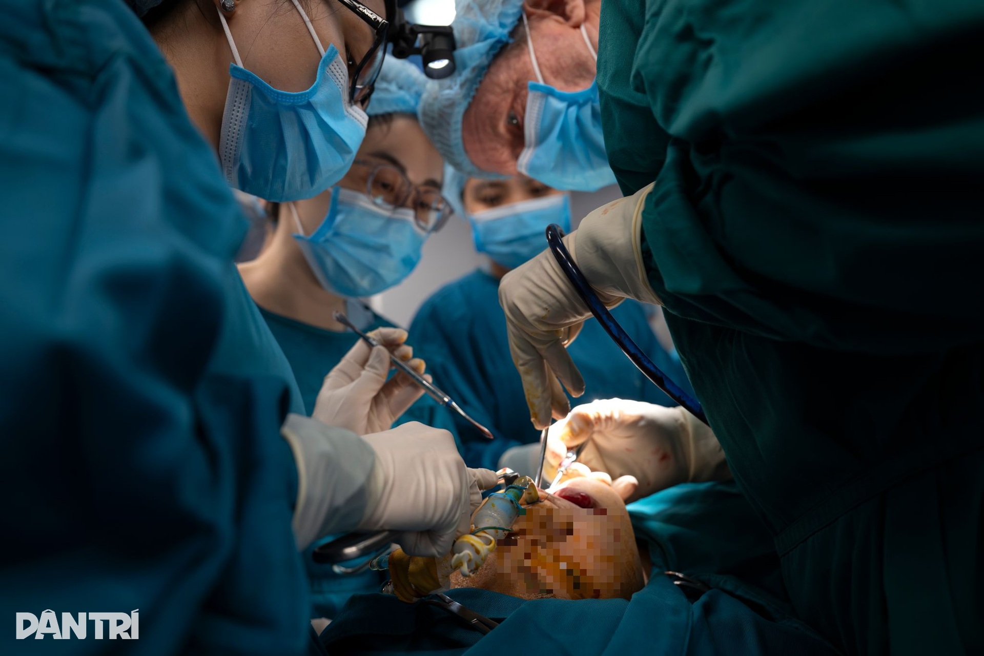 Hồi hộp xem đôi tay bác sĩ Việt - Mỹ tái tạo gương mặt cậu bé dị tật - 10