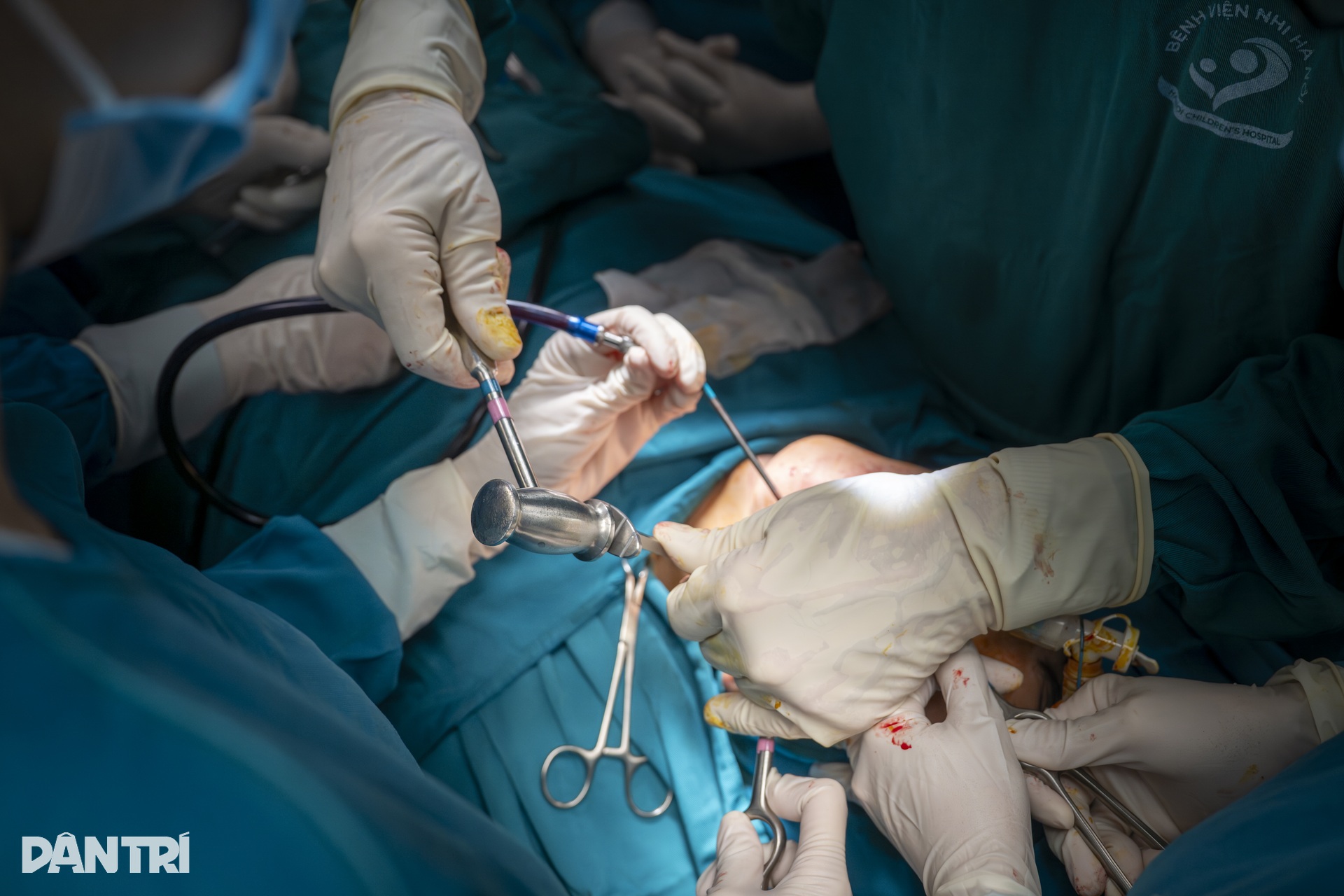 Hồi hộp xem đôi tay bác sĩ Việt - Mỹ tái tạo gương mặt cậu bé dị tật - 14