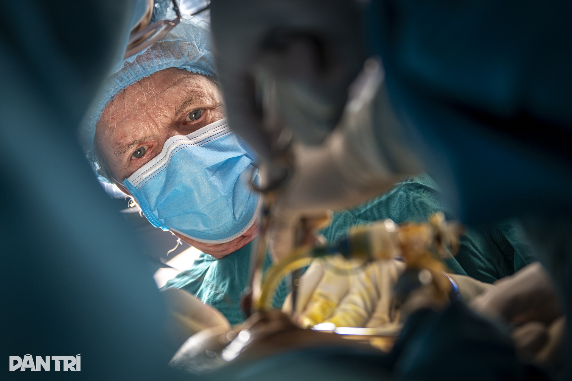 Hồi hộp xem đôi tay bác sĩ Việt - Mỹ tái tạo gương mặt cậu bé dị tật - 15