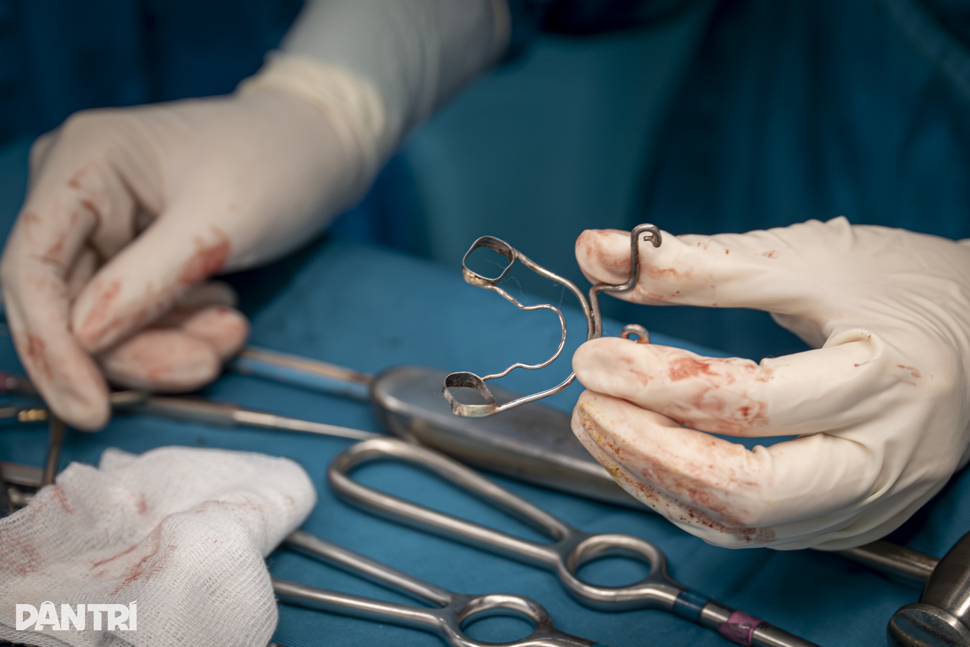 Hồi hộp xem đôi tay bác sĩ Việt - Mỹ tái tạo gương mặt cậu bé dị tật - 17