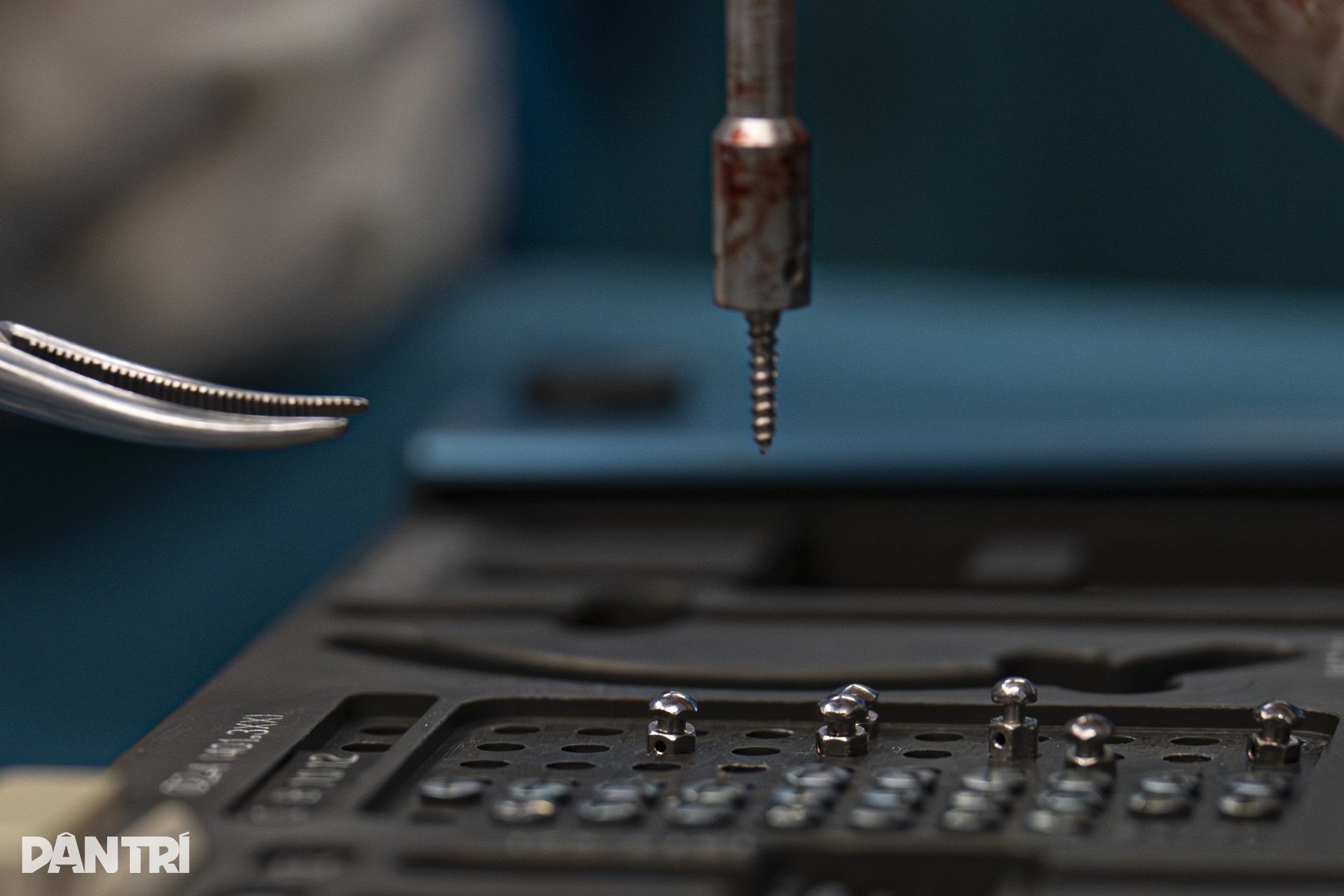 Hồi hộp xem đôi tay bác sĩ Việt - Mỹ tái tạo gương mặt cậu bé dị tật - 19