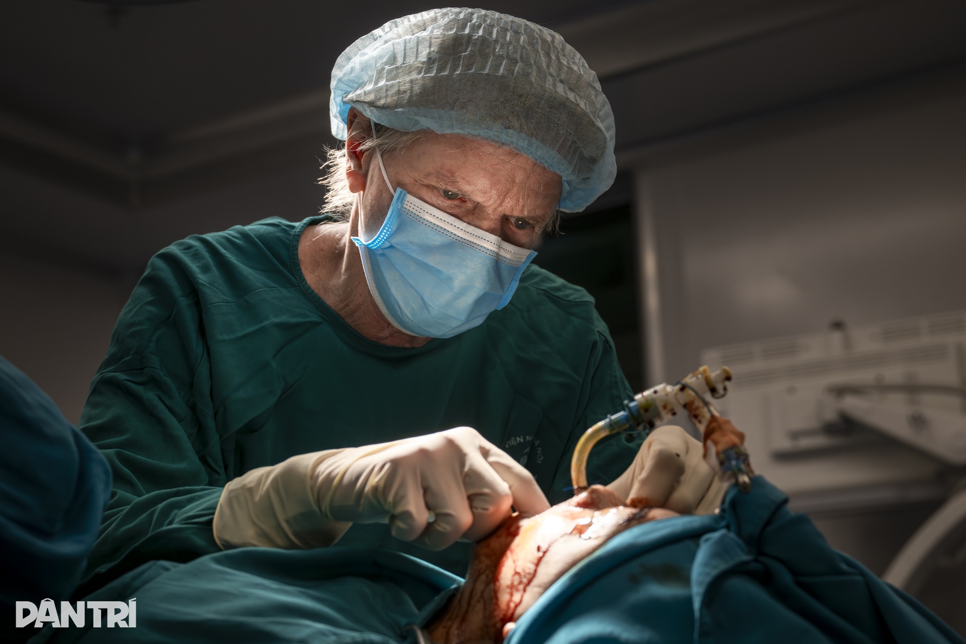 Hồi hộp xem đôi tay bác sĩ Việt - Mỹ tái tạo gương mặt cậu bé dị tật - 22