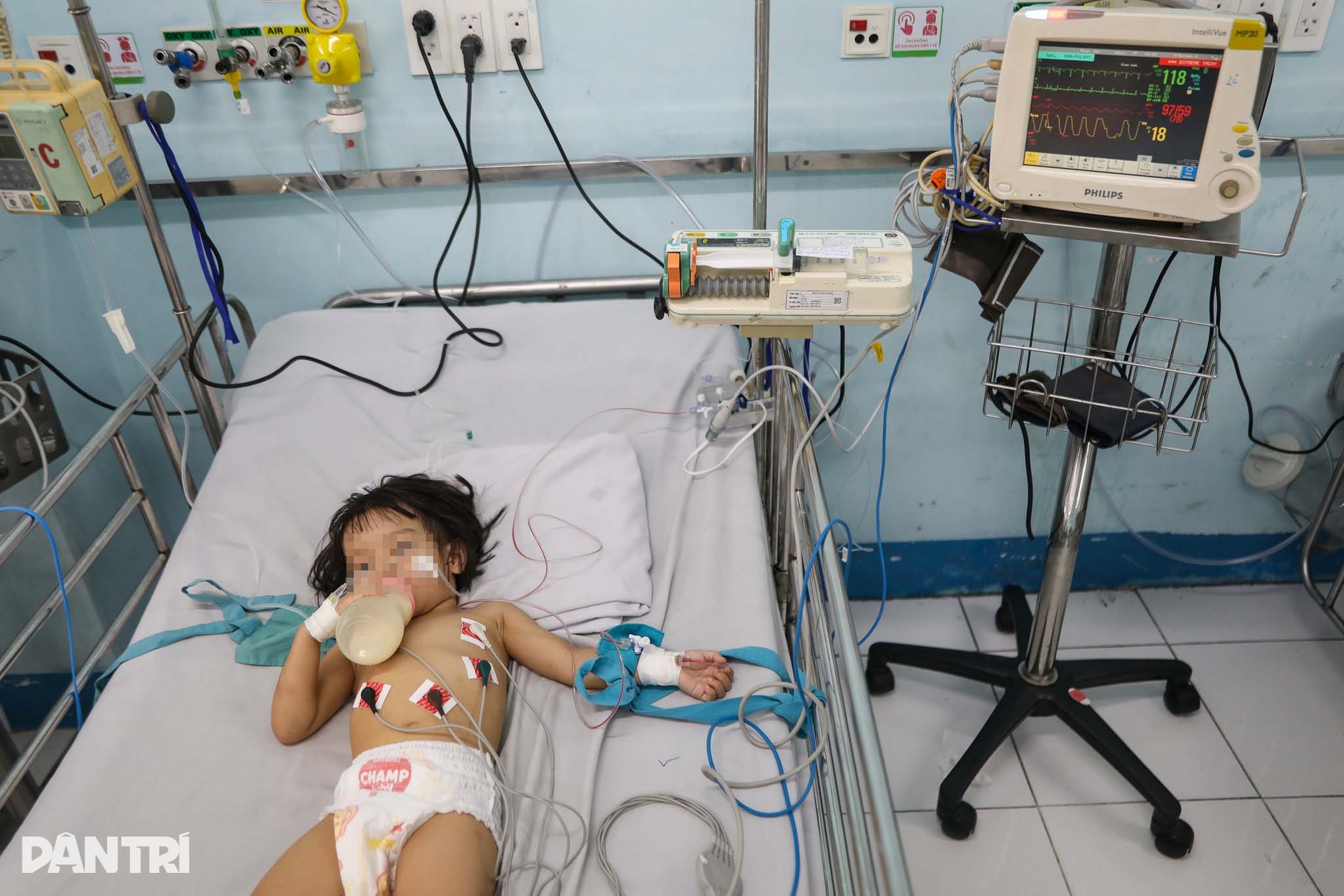 Bên trong nơi cứu chữa trẻ mắc tay chân miệng nặng, biến chứng ngưng thở - 2