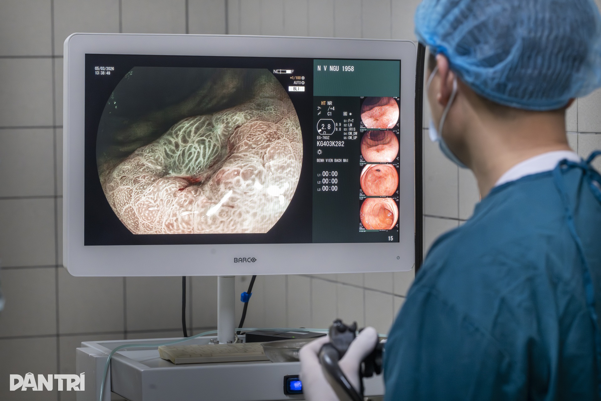 Xem bác sĩ biến ung thư thành bong bóng, loại bỏ hoàn toàn khỏi dạ dày - 9