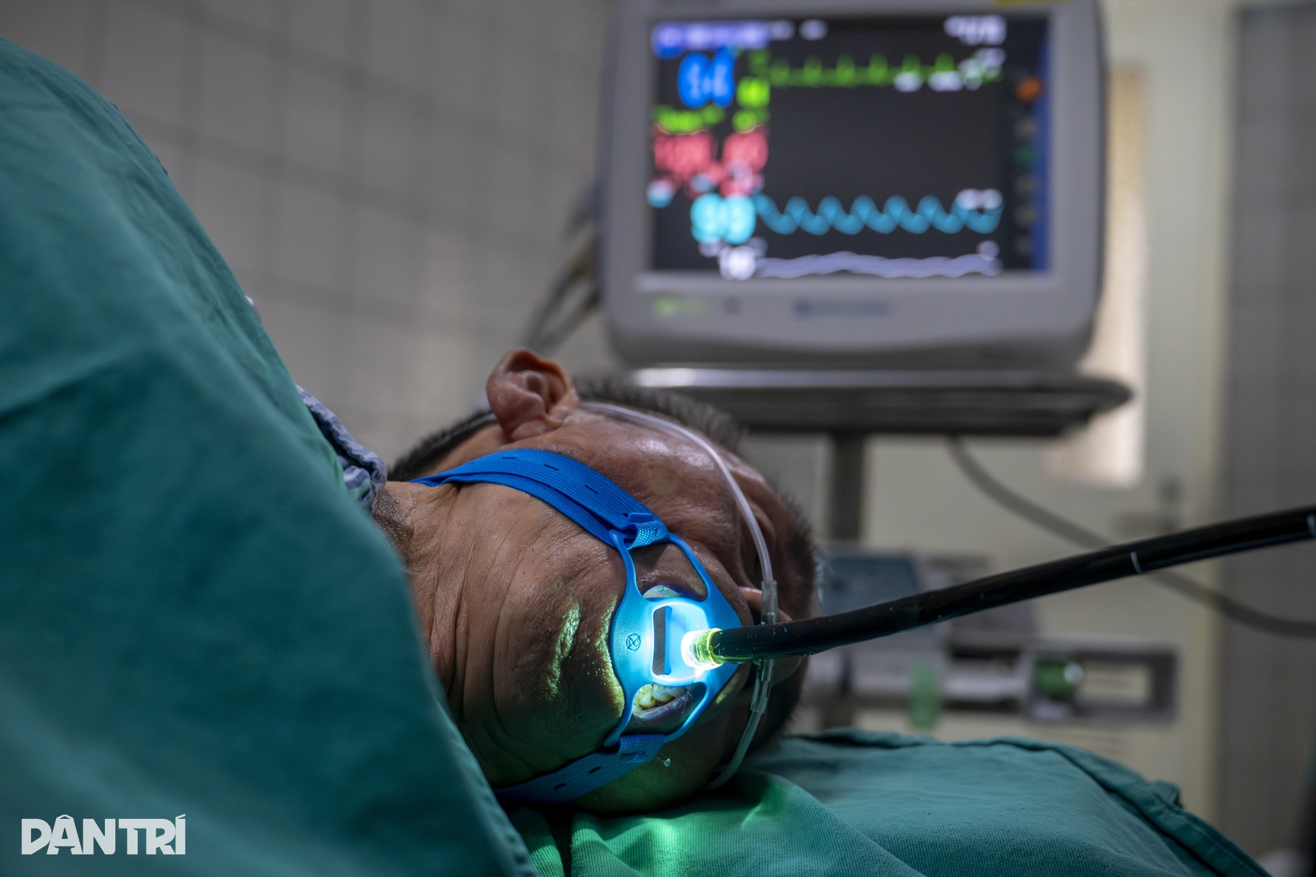 Xem bác sĩ biến ung thư thành bong bóng, loại bỏ hoàn toàn khỏi dạ dày - 11