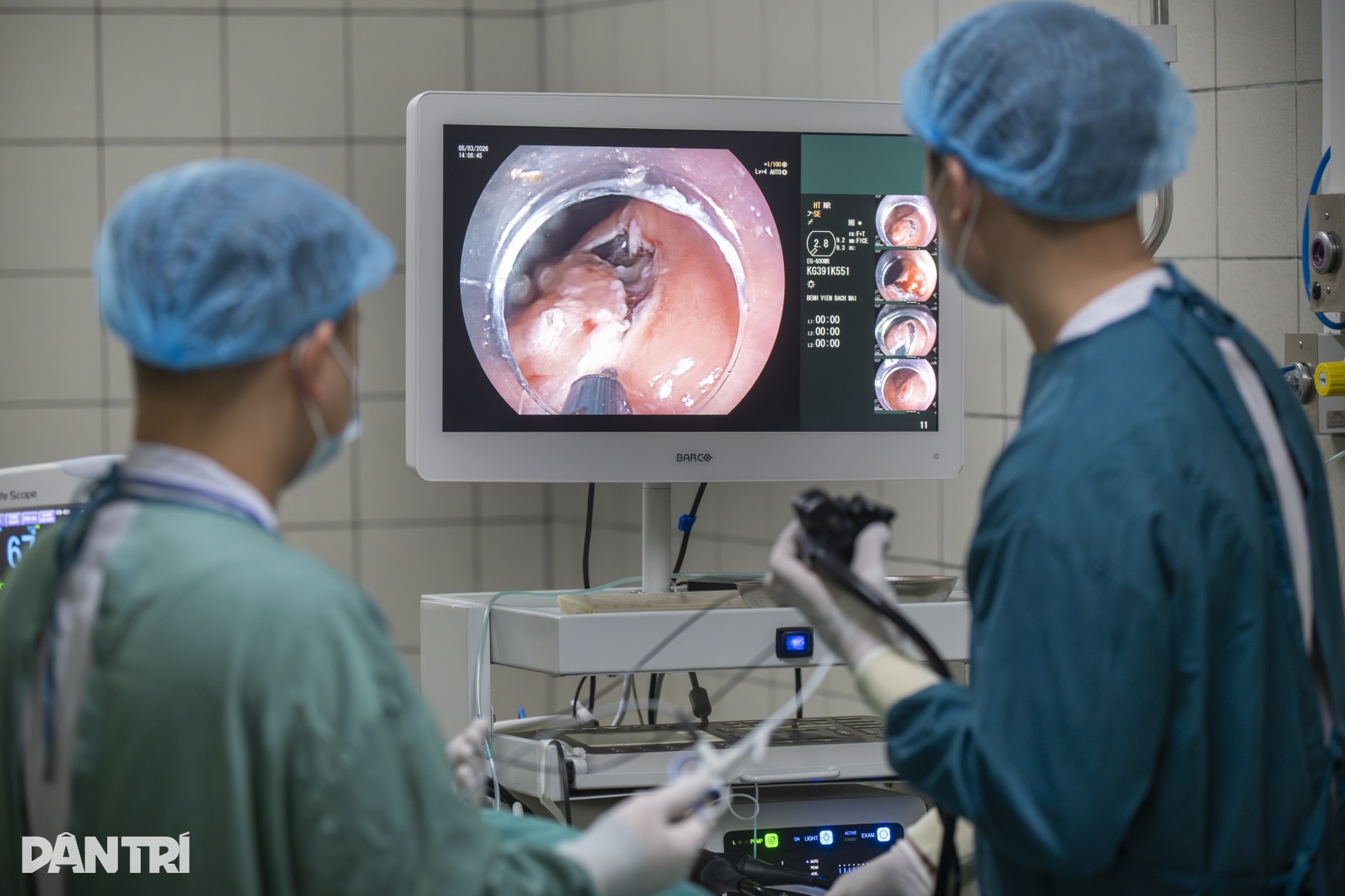 Xem bác sĩ biến ung thư thành bong bóng, loại bỏ hoàn toàn khỏi dạ dày - 16