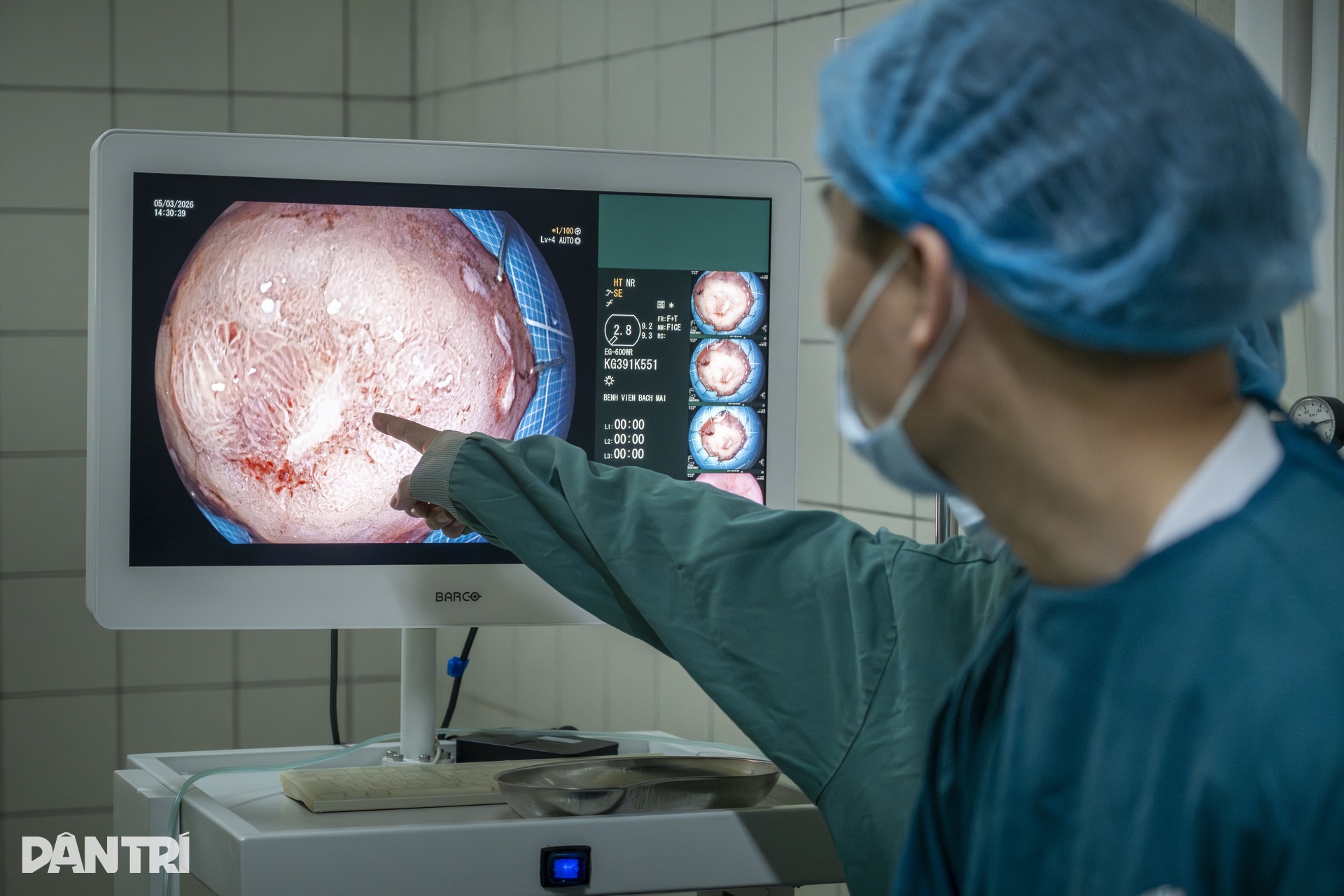 Xem bác sĩ biến ung thư thành bong bóng, loại bỏ hoàn toàn khỏi dạ dày - 21