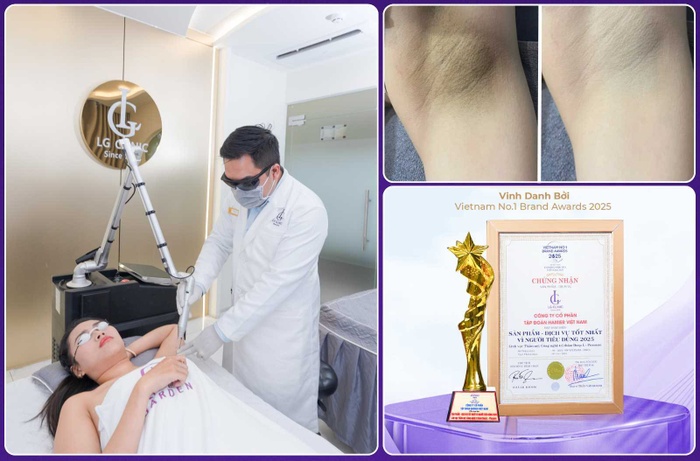 5 lý do giúp LG Clinic giữ vị thế dẫn đầu dịch vụ trị thâm nách tại TP.HCM suốt nhiều năm