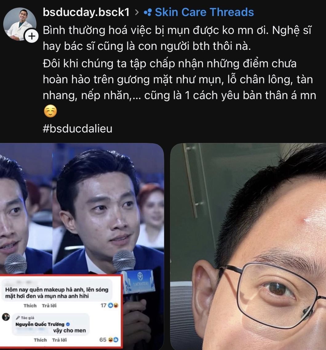 Bác sĩ da liễu nổi tiếng lên tiếng về mặt mụn của Quốc Trường- Ảnh 2.