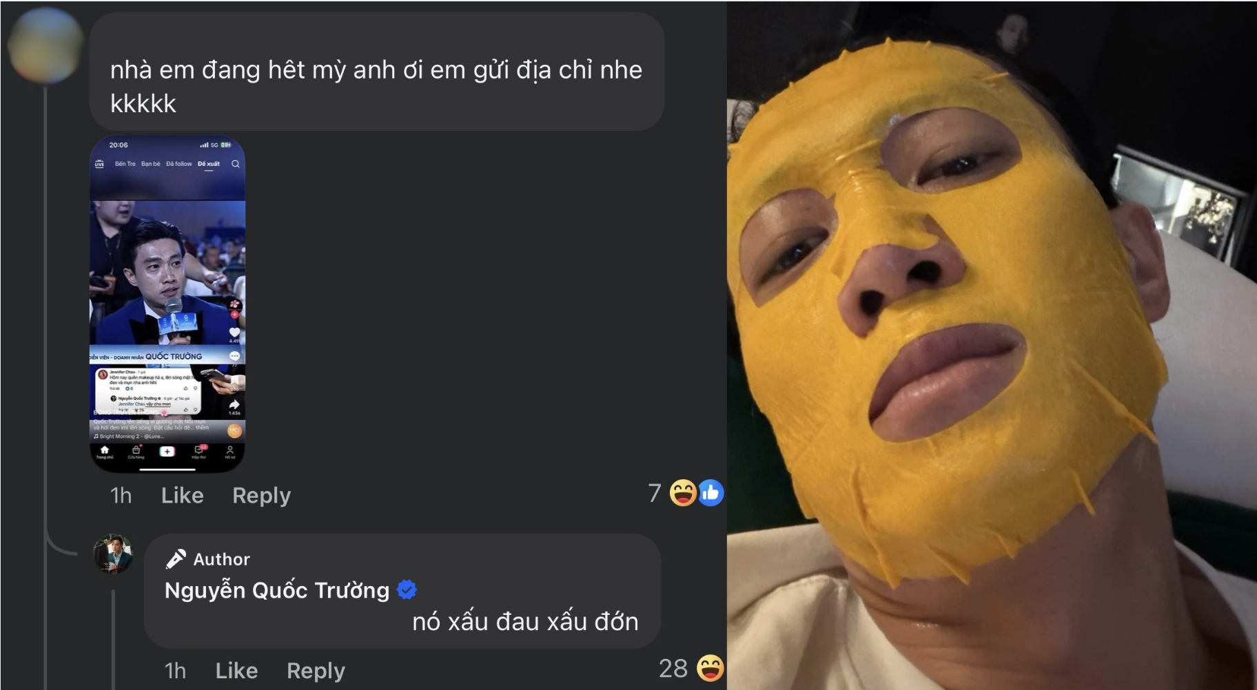 Bác sĩ da liễu nổi tiếng lên tiếng về mặt mụn của Quốc Trường- Ảnh 4.