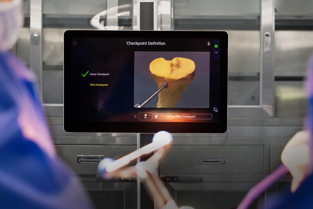 Vinmec ra mắt robot hỗ trợ thay khớp gối với chi phí hợp lý, tích hợp công nghệ AI - 2